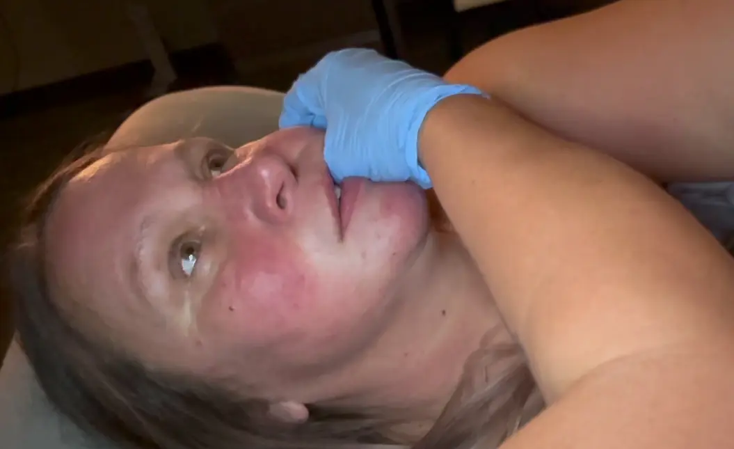 TMJ Massage Intraoral