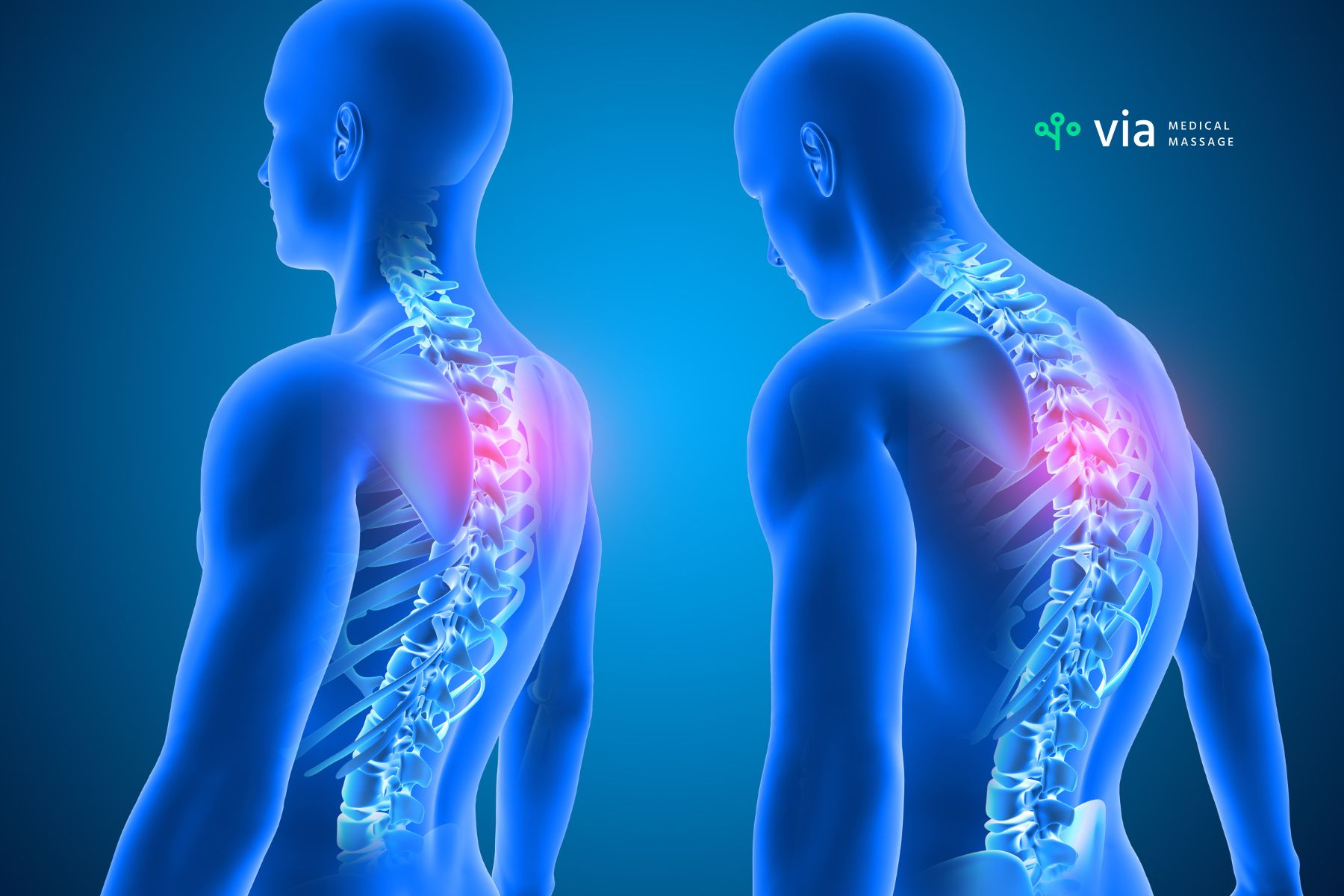 How posture impacts nerve and muscle pain